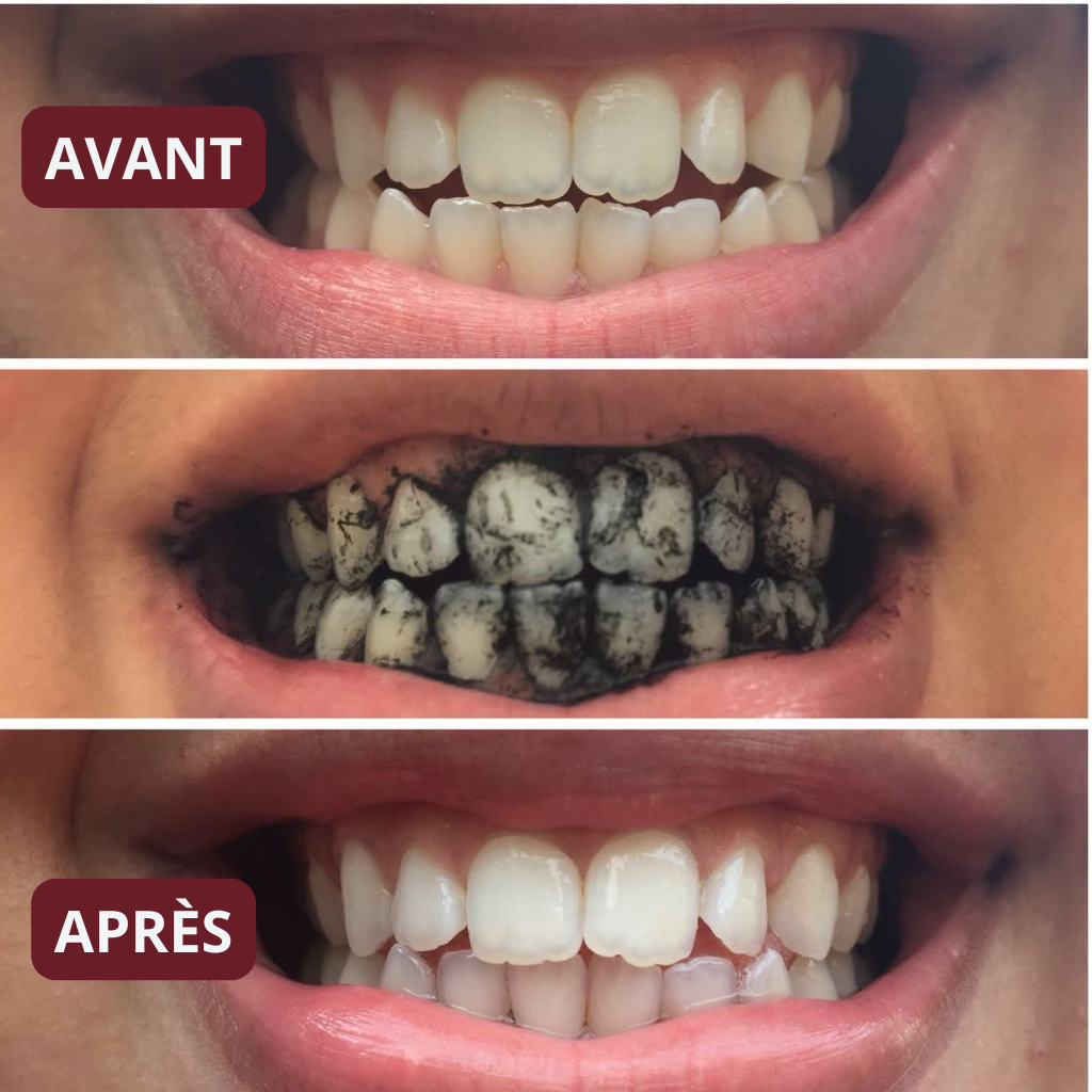 Kit Soin & Blancheur 7-en-1 au Siwak