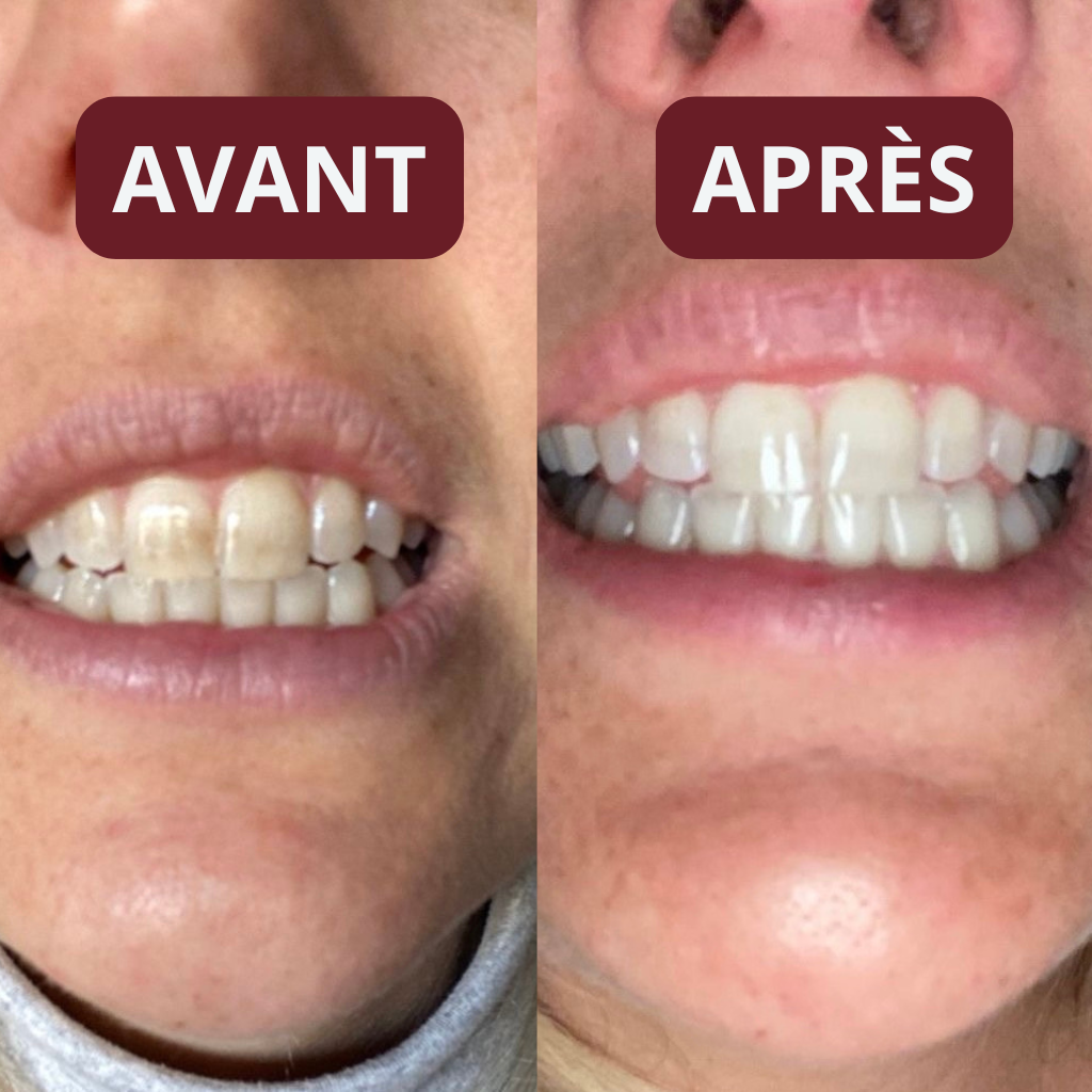 Bandes Dentaires Bio-Actives au Siwak