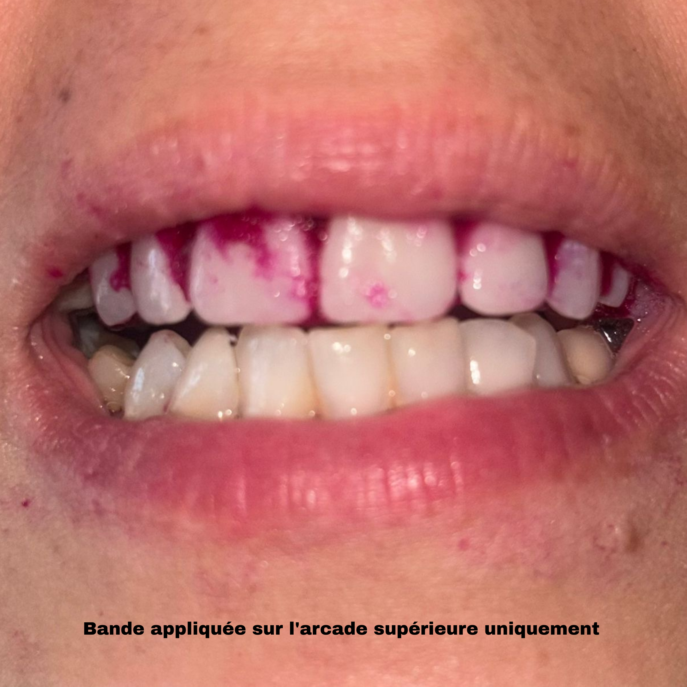 Bandes Dentaires Bio-Actives au Siwak