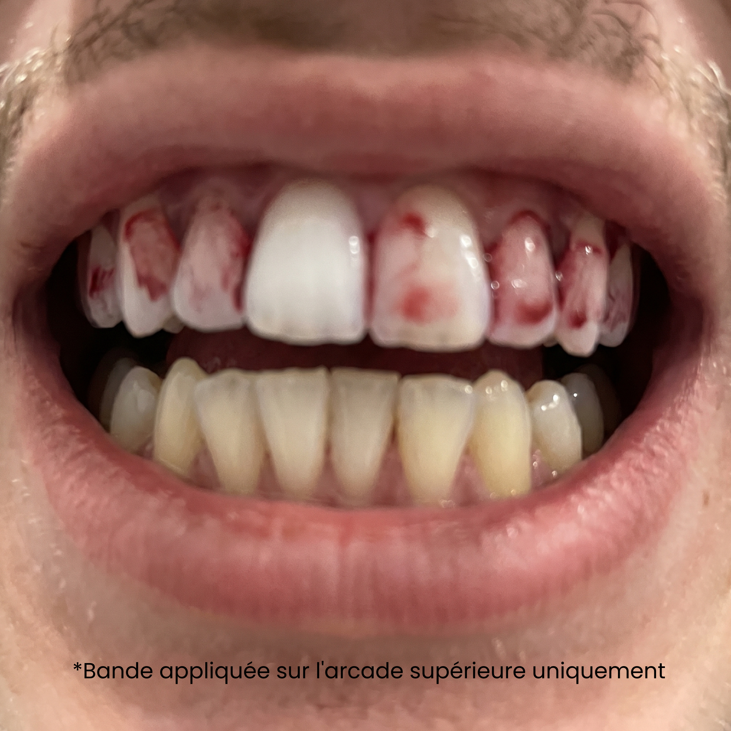 Bandes Dentaires Bio-Actives au Siwak