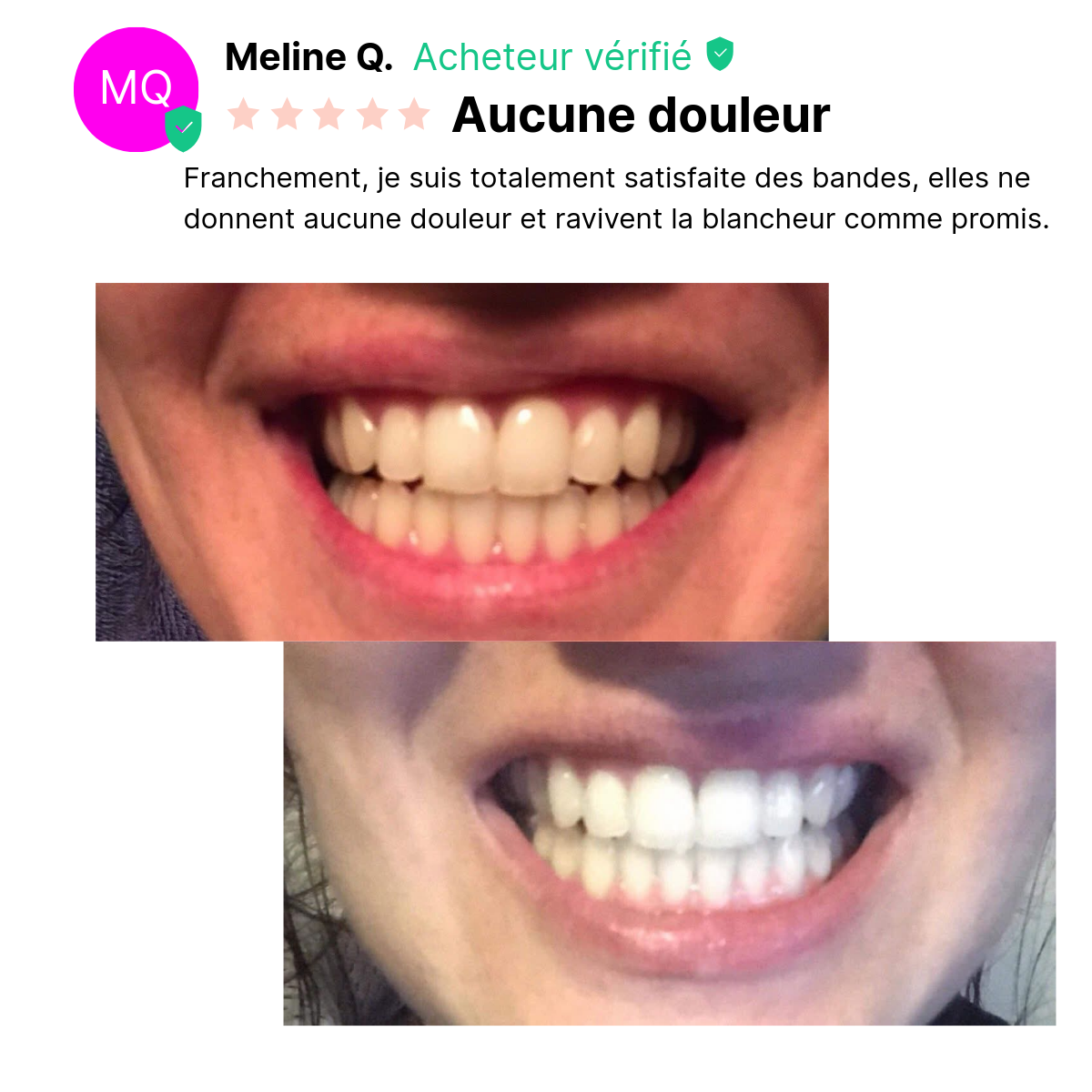 Bandes Dentaires Bio-Actives au Siwak
