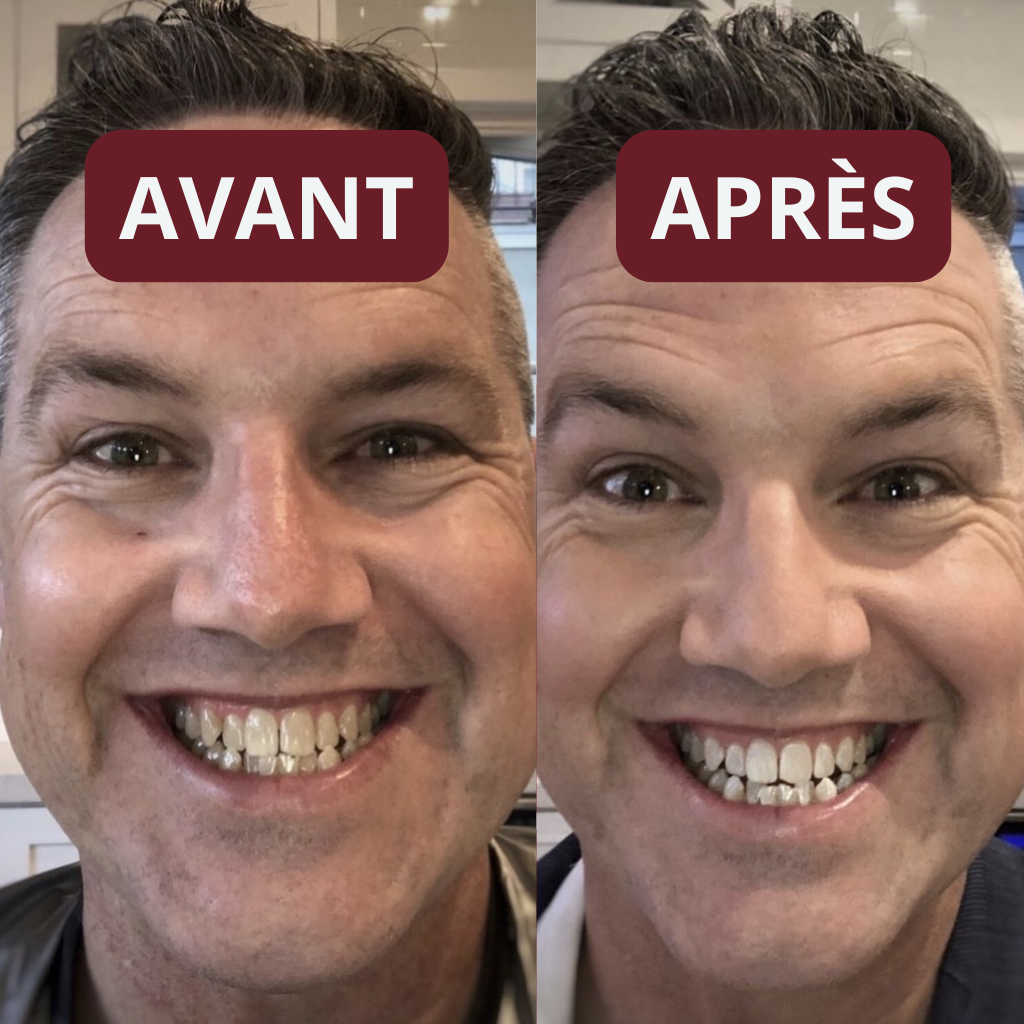 Bandes Dentaires Bio-Actives au Siwak