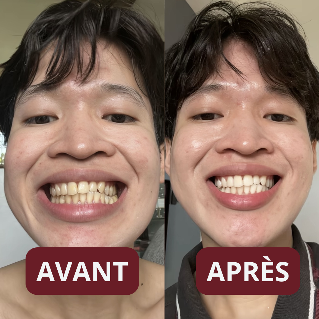 Kit Soin & Blancheur 7-en-1 au Siwak