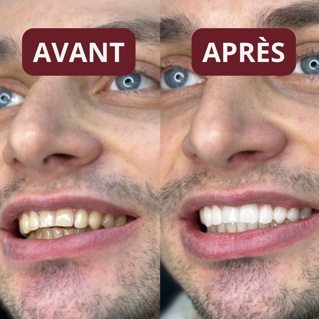 Bandes Dentaires Bio-Actives au Siwak