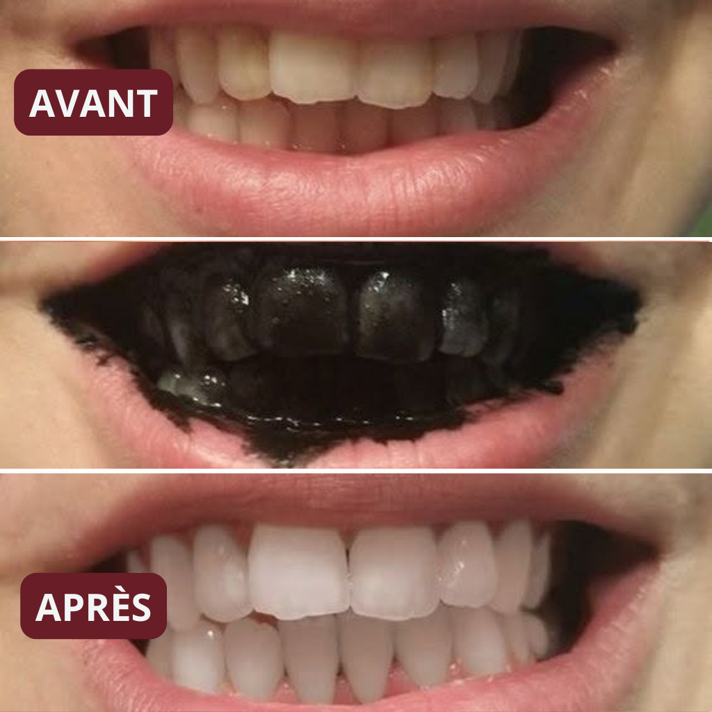 Kit Soin & Blancheur 7-en-1 au Siwak