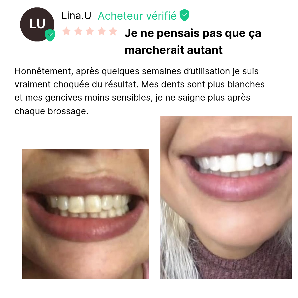 Kit Soin & Blancheur 7-en-1 au Siwak